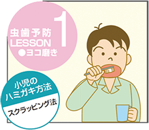 虫歯予防レッスン1-ヨコ磨き