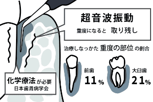従来の方法